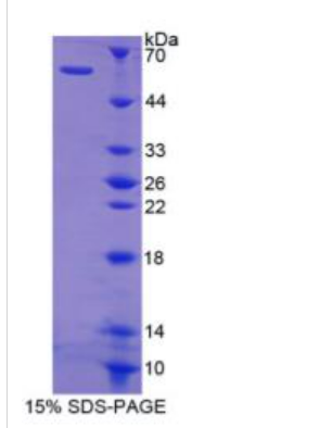 貓眼綜合征染色體區(qū)候選基因1(CECR1)重組蛋白,Recombinant Cat Eye Syndrome Chromosome Region, Candidate 1 (CECR1)