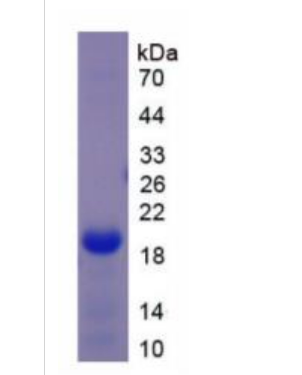 DEAD框肽5(DDX5)重组蛋白,Recombinant DEAD Box Polypeptide 5 (DDX5)