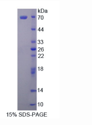 MARCKS相关蛋白(MARCKSL1)重组蛋白,Recombinant MARCKS Related Protein (MARCKSL1)