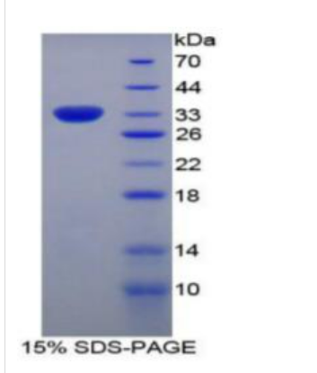 黏病毒耐藥蛋白1(MX1)重組蛋白,Recombinant Myxovirus Resistance 1 (MX1)