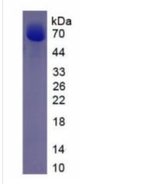 無翅型MMTV整合位點(diǎn)家族成員1(WNT1)重組蛋白,Recombinant Wingless Type MMTV Integration Site Family, Member 1 (WNT1)
