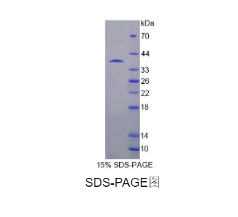 USP6氨基端样蛋白(USP6NL)重组蛋白,Recombinant USP6 N-Terminal Like Protein (USP6NL)