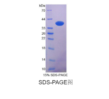 N-myc下游调节基因2(NDRG2)重组蛋白,Recombinant N-myc Downstream Regulated Gene 2 (NDRG2)