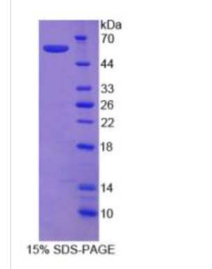 信號素3E(SEMA3E)重組蛋白,Recombinant Semaphorin 3E (SEMA3E)