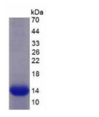 信號(hào)素5B(SEMA5B)重組蛋白,Recombinant Semaphorin 5B (SEMA5B)