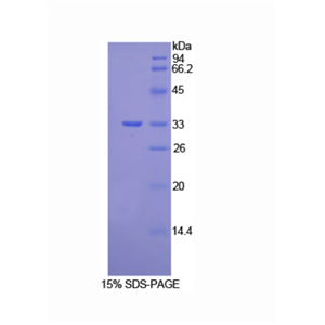 Vang样蛋白1(VANGL1)重组蛋白,Recombinant Vang Like Protein 1 (VANGL1)