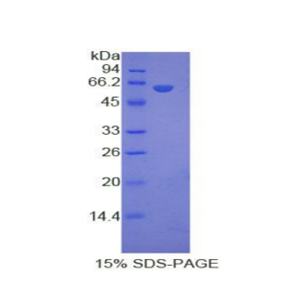 低密度脂蛋白受体相关蛋白8(LRP8)重组蛋白