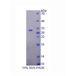 含DIX域蛋白1(DIXDC1)重組蛋白,Recombinant DIX Domain Containing Protein 1 (DIXDC1)