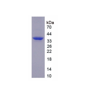 肿瘤坏死因子α诱导蛋白3,Recombinant Tumor Necrosis Factor Alpha Induced Protein 3 Interacting Protein 2 (TNIP2)