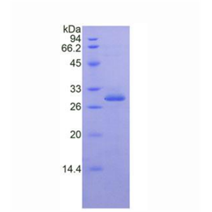 核因子κB抑制因子ε(IkBe)重组蛋白,Recombinant Inhibitory Subunit Of NF Kappa B Epsilon (IkBe)