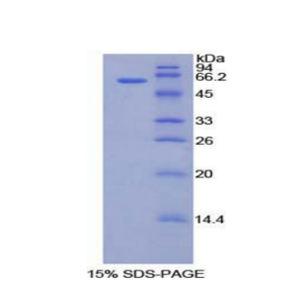 软骨中间层蛋白(CILP)重组蛋白,Recombinant Cartilage Intermediate Layer Protein (CILP)