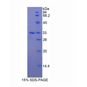 GRB2关联结合蛋白3(GAB3)重组蛋白,Recombinant GRB2 Associated Binding Protein 3 (GAB3)