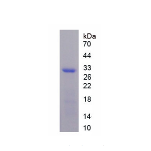 低密度脂蛋白受體相關(guān)蛋白3(LRP3)重組蛋白