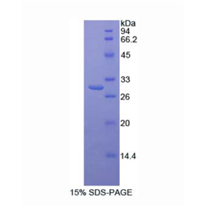 丝裂原激活蛋白激酶激酶激酶7,Recombinant Mitogen Activated Protein Kinase Kinase Kinase 7 Interacting Protein 1 (MAP3K7IP1)