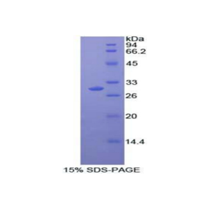 丝裂原激活蛋白激酶11(MAPK11)重组蛋白,Recombinant Mitogen Activated Protein Kinase 11 (MAPK11)