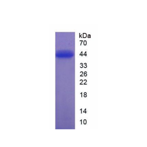 蛋白激酶Bα(PKBa)重组蛋白,Recombinant Protein Kinase B Alpha (PKBa)