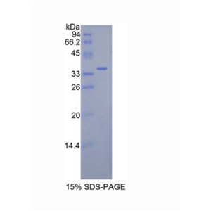 无补缀同源物1(DISP1)重组蛋白