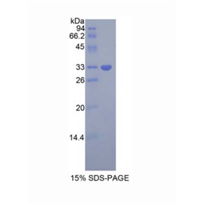 生长因子受体结合蛋白7(Grb7)重组蛋白,Recombinant Growth Factor Receptor Bound Protein 7 (Grb7)