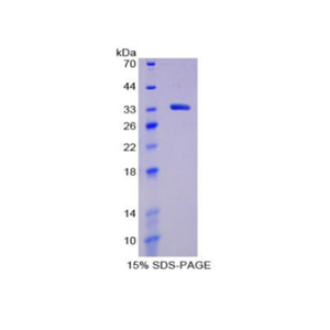 淋巴细胞激活基因3(LAG3)重组蛋白,Recombinant Lymphocyte Activation Gene 3 (LAG3)