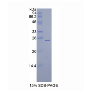 侧支发芽因子同源物1(SPRY1)重组蛋白
