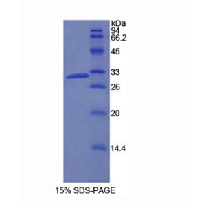 磷酸肌醇-3-激酶2β肽(PIK3C2b)重組蛋白,Recombinant Phosphoinositide-3-Kinase Class-2-Beta Polypeptide (PIK3C2b)