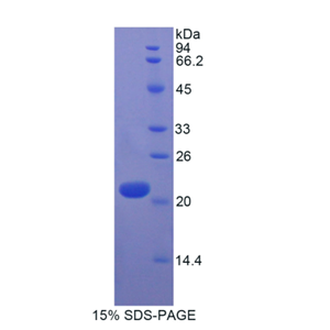 中间小电导钙激活钾离子通道亚家族N成员2(KCNN2)重组蛋白,Recombinant Potassium Intermediate Small Conductance Calcium Activated Channel Subfamily N, Member 2 (KCNN2)