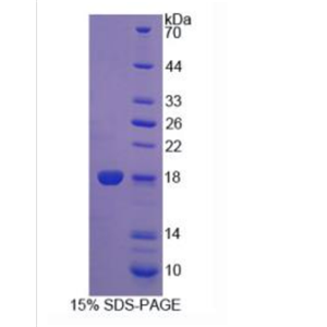 细胞程序性死亡蛋白5(PDCD5)重组蛋白