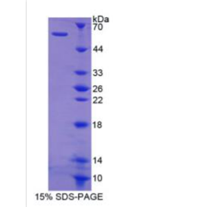 猫眼综合征染色体区候选基因1(CECR1)重组蛋白