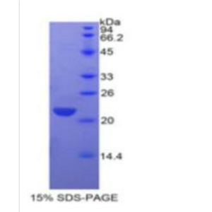 C-型凝集素域家族3成员B(CLEC3B)重组蛋白,Recombinant C-Type Lectin Domain Family 3, Member B (CLEC3B)