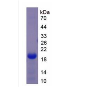 DEAD框肽5(DDX5)重组蛋白
