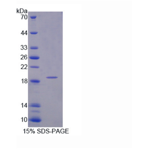 107kDa肌醇多聚磷酸-4-磷酸酶Ⅰ型(INPP4A)重组蛋白