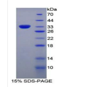 黏病毒耐药蛋白1(MX1)重组蛋白