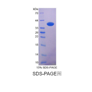 N-myc下游调节基因2(NDRG2)重组蛋白