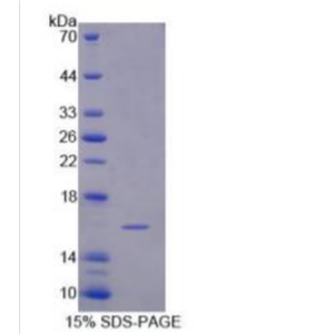 信号素3C(SEMA3C)重组蛋白,Recombinant Semaphorin 3C (SEMA3C)