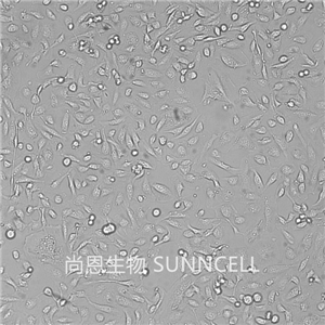 786-O细胞人肾透明细胞腺癌细胞