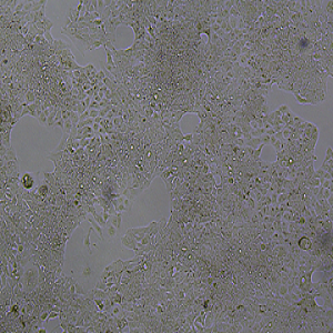 HCC827细胞|HCC827人肺腺癌细胞,HCC827