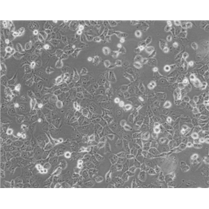 NCI-H1299细胞|NCI-H1299人非小细胞肺癌细胞,NCI-H1299