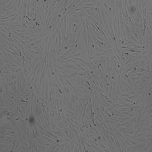 SF126细胞|SF126人胶质母细胞瘤细胞