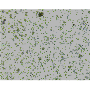 WERI-Rb-1细胞|WERI-Rb-1人视网膜神经胶质瘤细胞