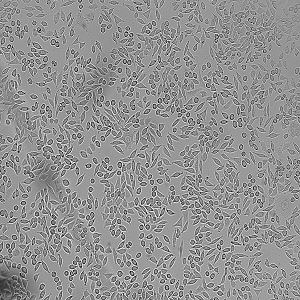 NCTC clone 929 [L cell, L-929]细胞|NCTC clone 929小鼠成纤维细胞,NCTC clone 929 [L cell, L-929]