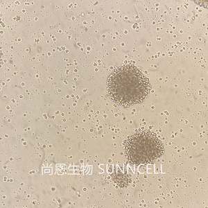 NK-92细胞|NK-92人恶性非霍奇金淋巴瘤患者的自然杀伤细胞,NK-92