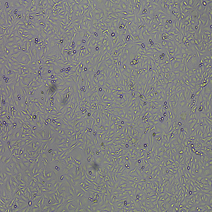 SV40 MES 13细胞|SV40 MES 13小鼠淋巴结内皮细胞