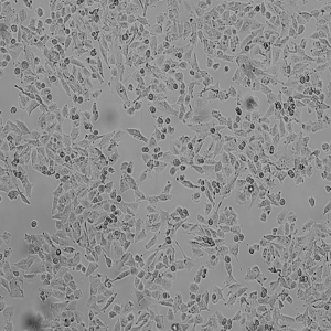 PATU8988T细胞|PATU8988T人胰腺癌细胞