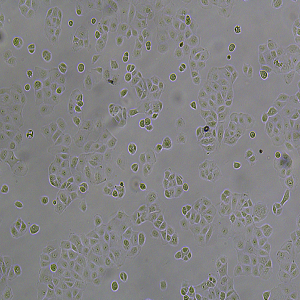 NIH:OVCAR-3 [OVCAR3]细胞|OVCAR3人卵巢癌细胞