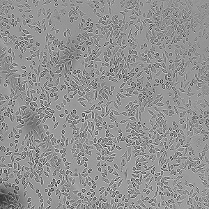 NCTC clone 929 [L cell, L-929]细胞|NCTC clone 929小鼠成纤维细胞