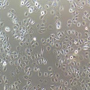 NCI-H661细胞|NCI-H661人大细胞肺癌细胞