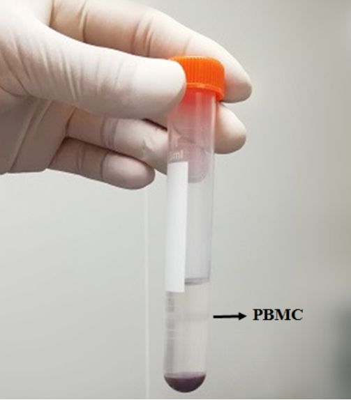 人肝微粒体 HLM/Human Liver Microsomes,IPHASE Human Liver Microsomes