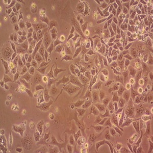 人急性单核细胞白血病细胞,THP-1