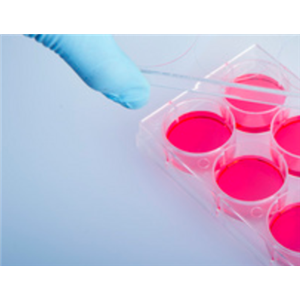 外周血单个核细胞分离试剂盒 PBMC分离液