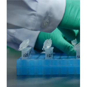 CYP450酶代谢表型研究试剂盒-重组酶法/单酶,CYP450 Metabolic Phenotype Research kit